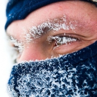 На Львівщині 4 людей потрапили до лікарні з обмороженнями На Львівщині 4 людей потрапили до лікарні з обмороженнями