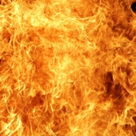 У Золочівському районі внаслідок пожежі в квартирі отримав опіки власник У Золочівському районі внаслідок пожежі в квартирі отримав опіки власник