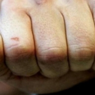 У Львові раніше судимий напав на пенсіонера У Львові раніше судимий напав на пенсіонера