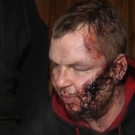 В Литве подтвердили, что Булатова пытали В Литве подтвердили, что Булатова пытали