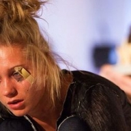 Асмус шокировала поклонников подбитым глазом Асмус шокировала поклонников подбитым глазом