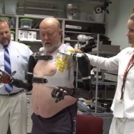 Ученые вживили мужчине протезы рук, управляемые силой мысли Ученые вживили мужчине протезы рук, управляемые силой мысли